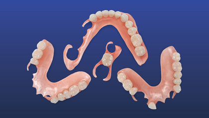 Why 3D Flexible Partials Are the Future image