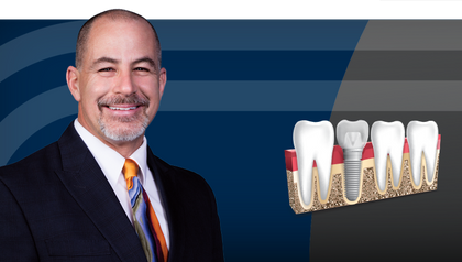 Implant Treatment Planning: The Contributing Factors image