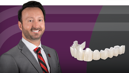 Using Laboratory Fabricated Provisionals image