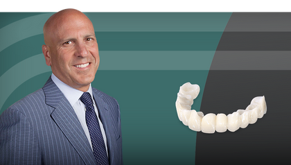 Bite Registration and Provisional Restorations image