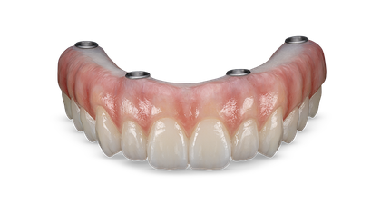 BruxZir® Esthetic Full-Arch Implant Prosthesis Signature Image image