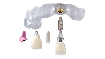 Glidewell™ Tooth Replacement Solution image