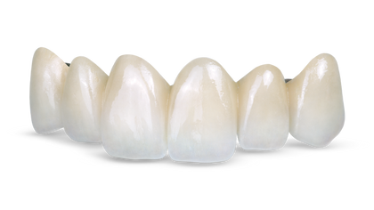 Obsidian Fused to Metal Signature Image image