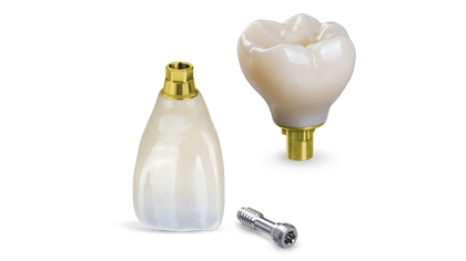 Screw-Retained Crowns Signature Image image