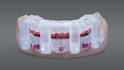 Stackable Surgical Guides image