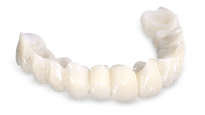 Transition Crowns Bridges Signature Images image