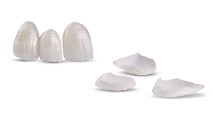 Veneers Signature Image image