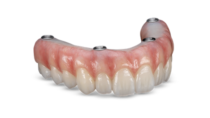 BruxZir® Full-Arch Implant Prosthesis image