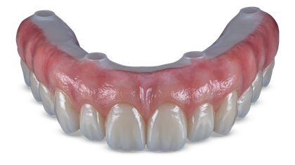 BruxZir® Esthetic Full-Arch Implant Prosthesis Signature Image image