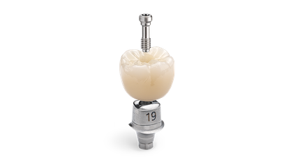  Screwmentable Crown Signature Image image