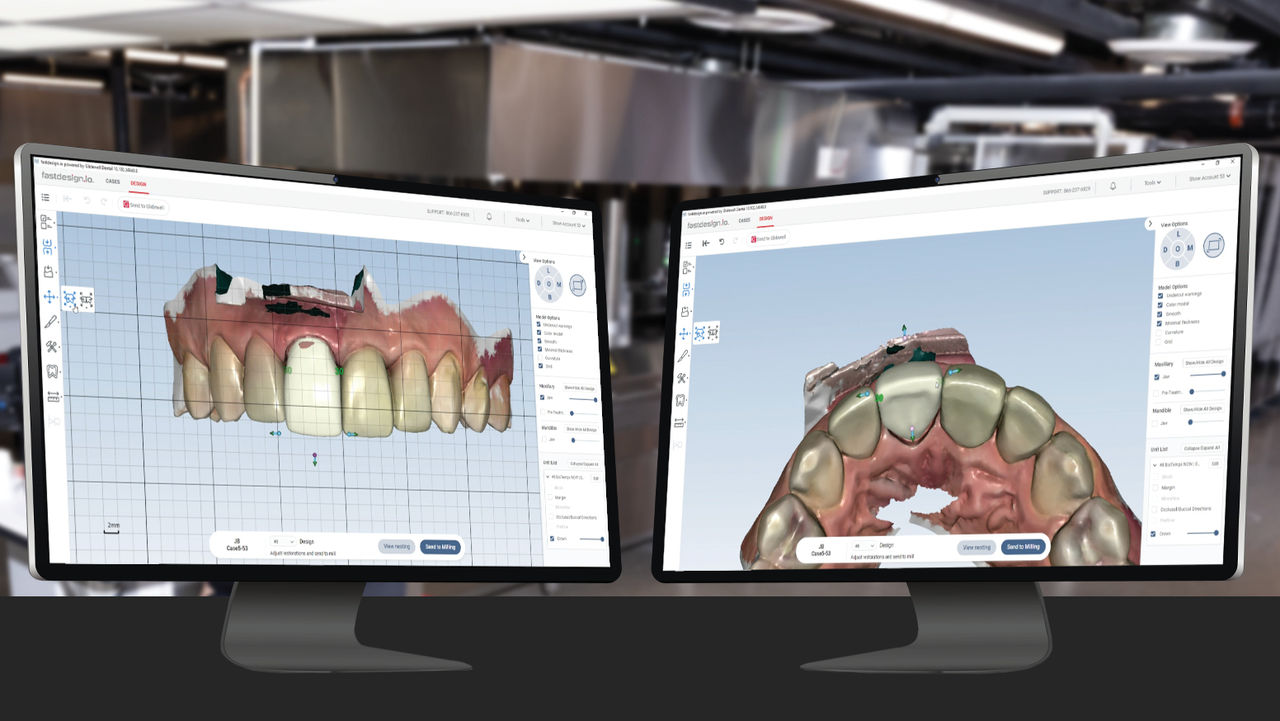 Fully Automated Modeling and Design