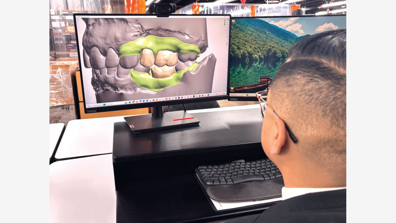 A dental technician uploads the digital intraoral scan file