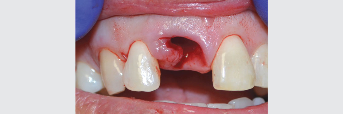 Biological and Technical Complications