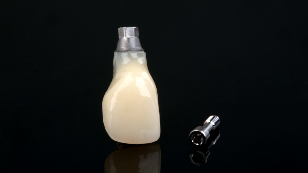 Screw-retained BioTemps Provisionals crown