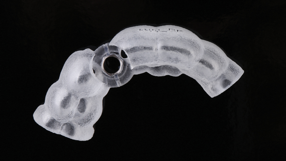 A tooth-supported surgical guide