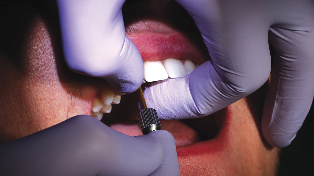 BioTemps provisional exhibiting a precise fit