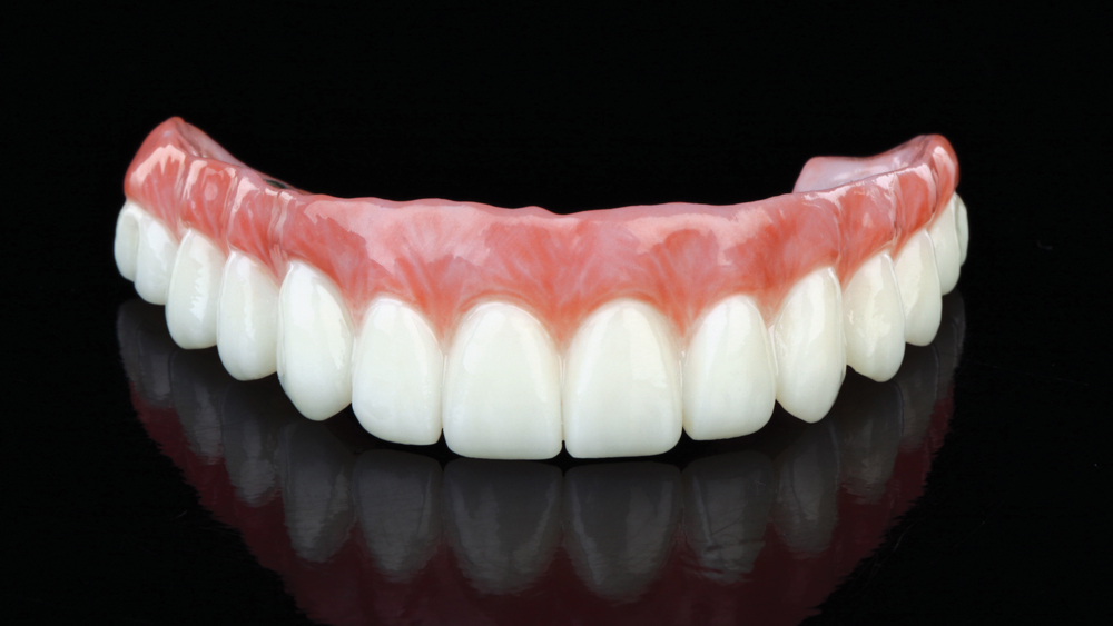 BruxZir Full-Arch Implant Prosthesis