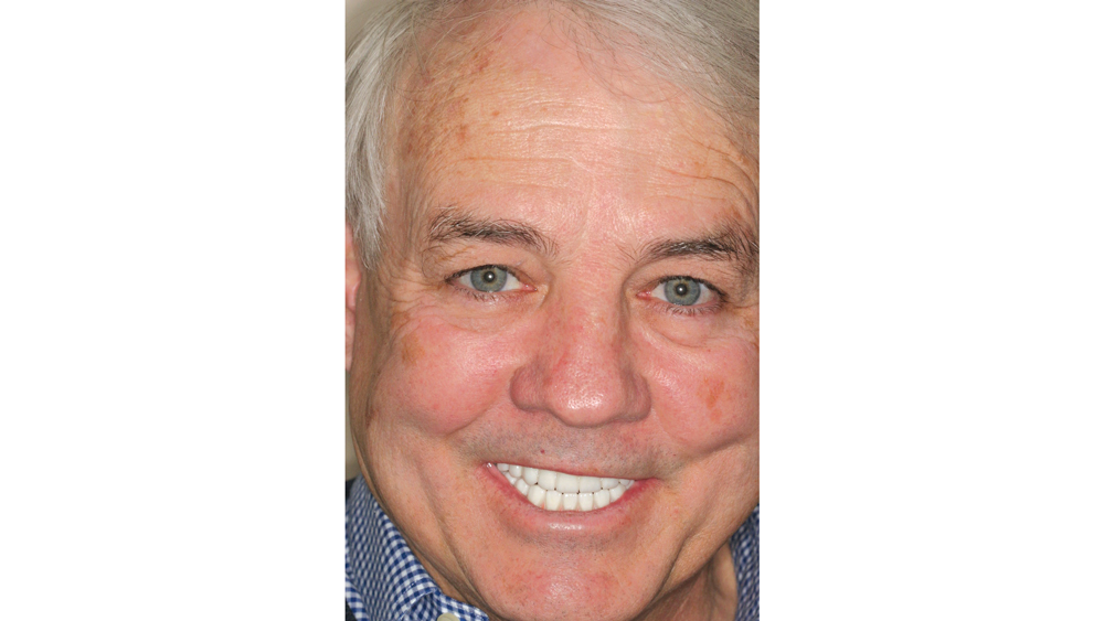 Happy patient's smile