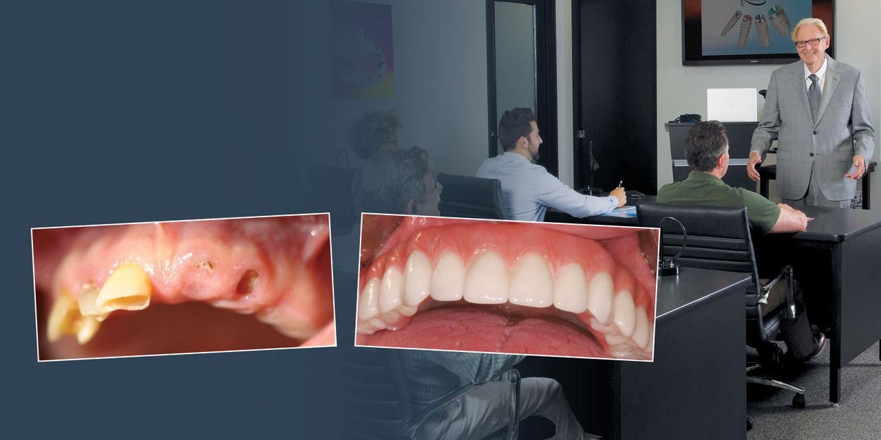 Extraction with Immediate Implant Placement in Full-Arch Indications Main Image