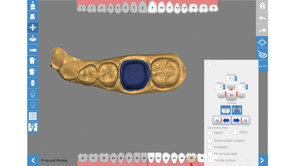 Intraoral Scanner Image #1
