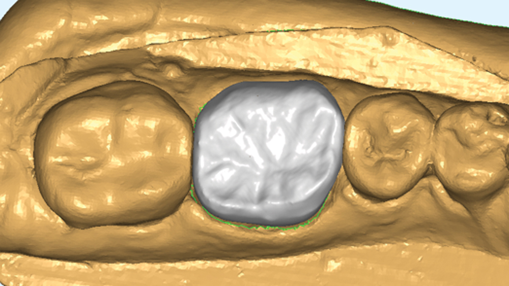 A crown produced automatically by generative adversarial networks (GANs) (top-view)