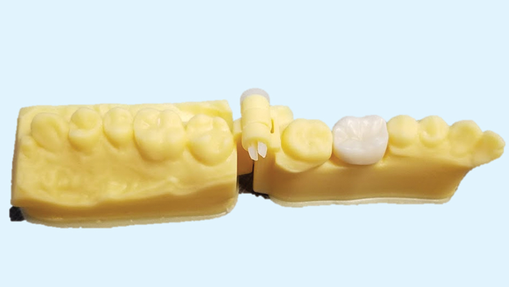 A crown produced automatically by generative adversarial networks (GANs) (side-view)