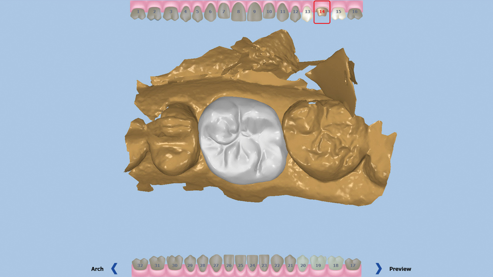Intraoral Scanner Image #3