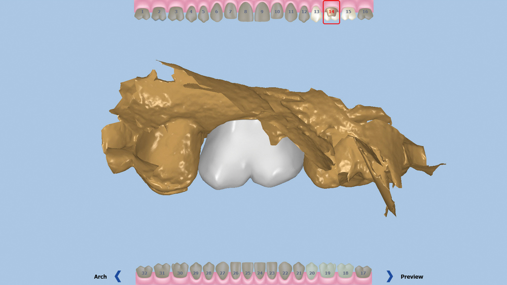 Intraoral Scanner Image #4
