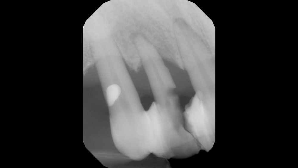 Figures 2a: preoperative radiography