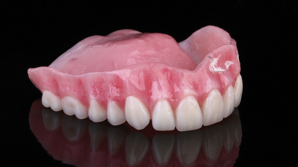 BruxZir Full-Arch Implant Prosthesis