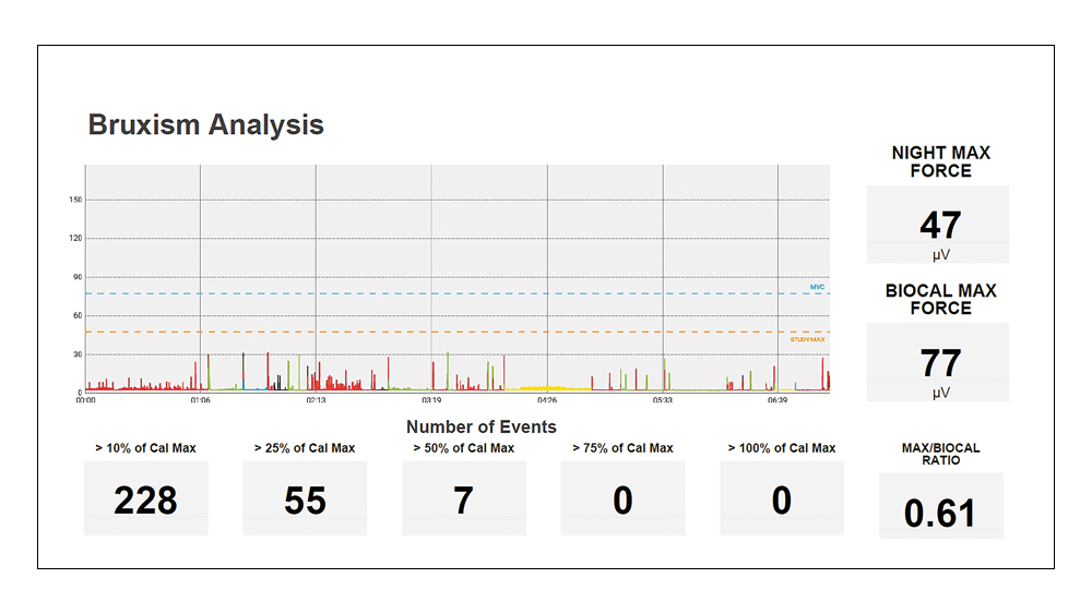 Bruxism Analysis chart