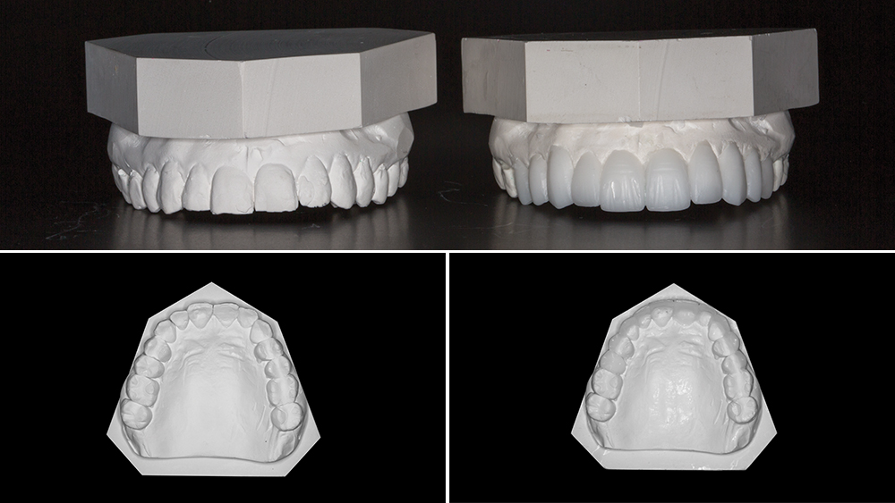 Diagnostic wax-up model