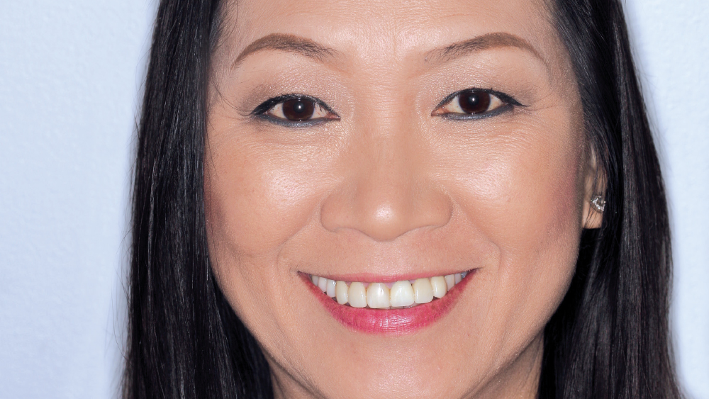 patient before photo