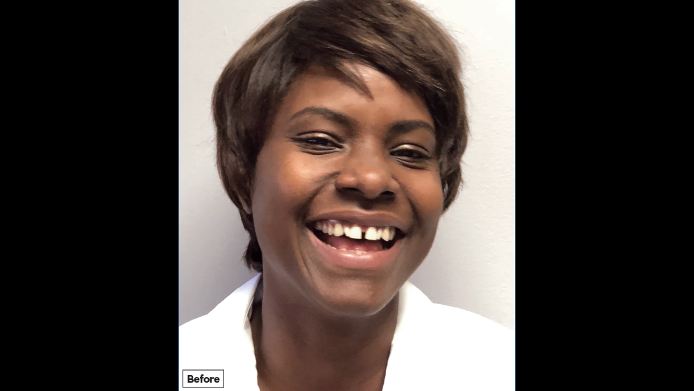 before photo of Renea