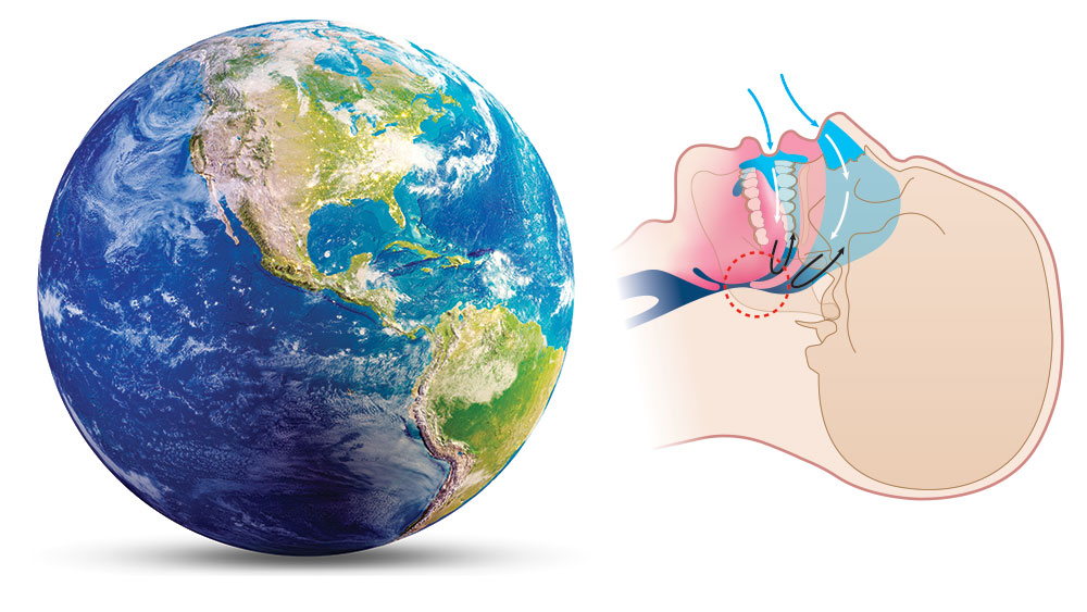 Sleep apnea a worldwide problem