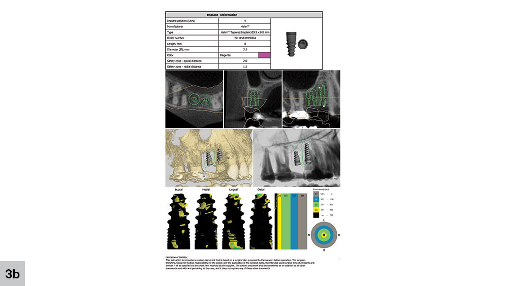 guide including specific recommendations for surgical treatment