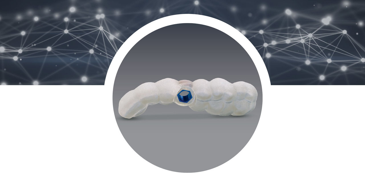 Surgical Guides with Digital Treatment Planning