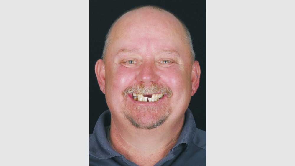 Patient before procedure