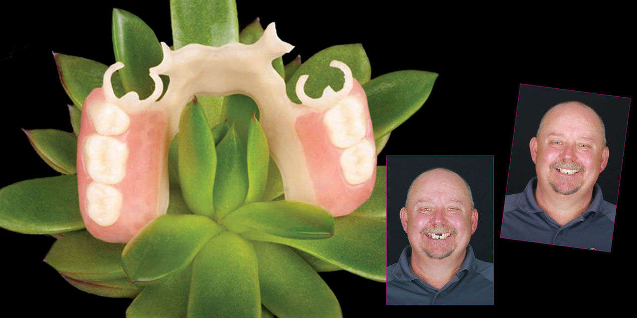 Patient with BioTemps Provisionals