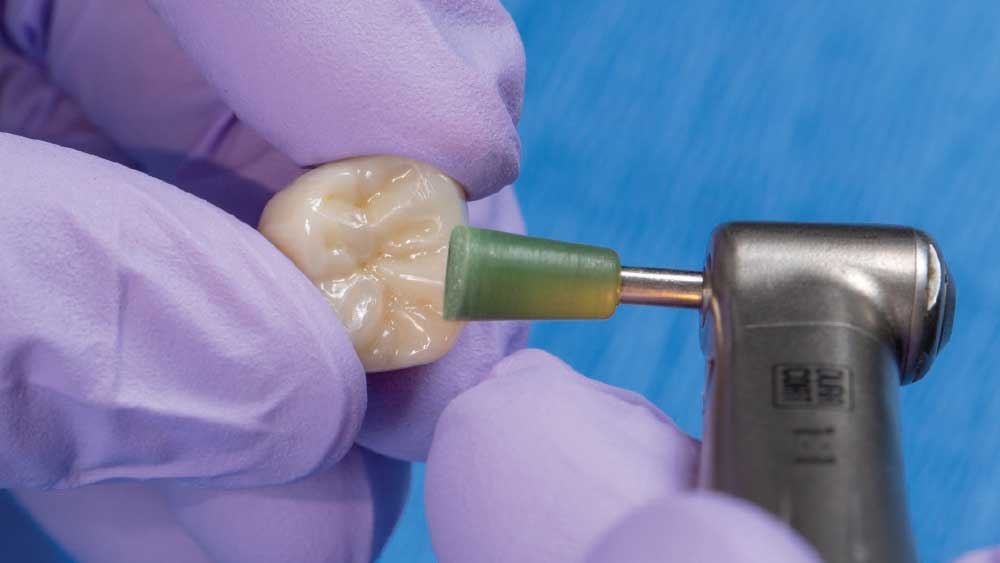 Pre-polish with green cup