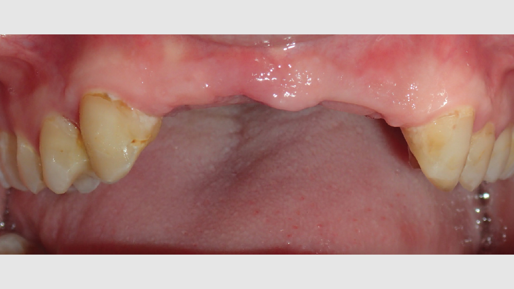 cm1403-lighting-esthetic-zone-01