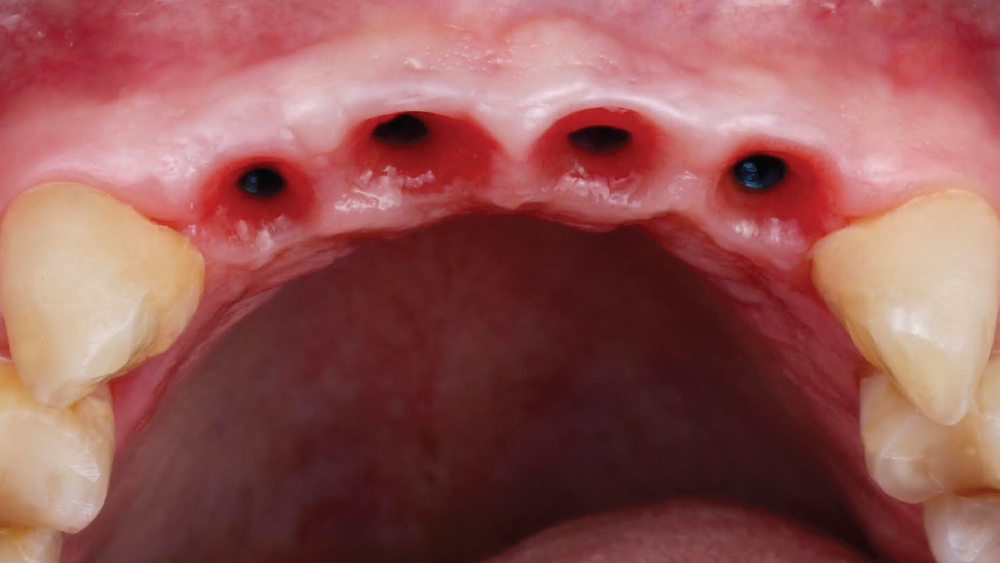 cm1403-lighting-esthetic-zone-09