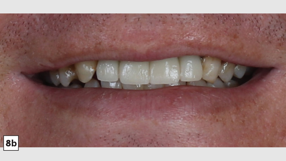 cm1403-lighting-esthetic-zone-08b