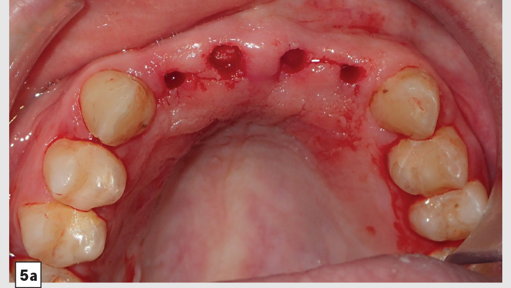 cm1403-lighting-esthetic-zone-05a