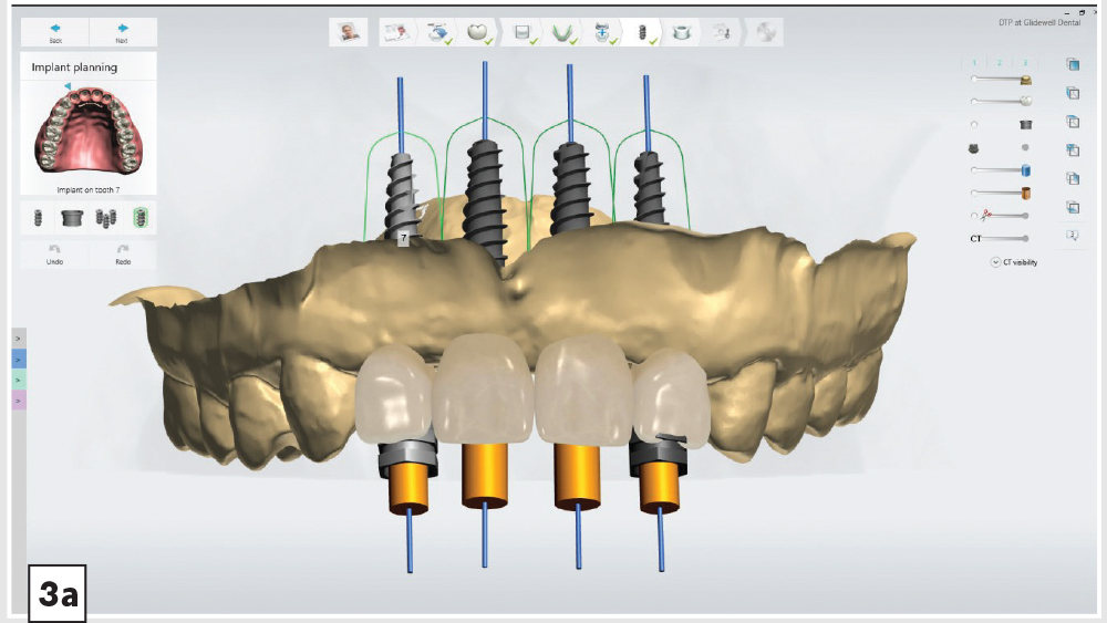 cm1403-lighting-esthetic-zone-03a