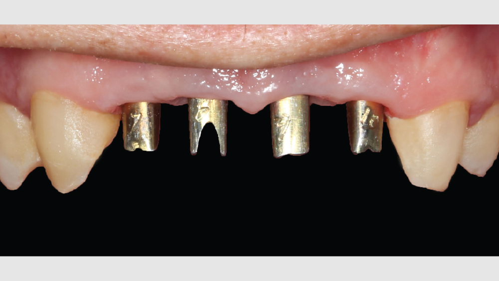 cm1403-lighting-esthetic-zone-10