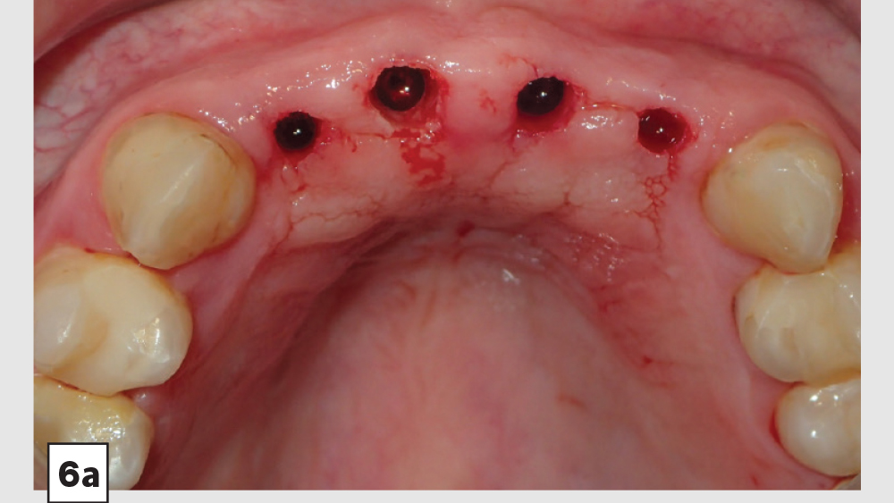 cm1403-lighting-esthetic-zone-06a