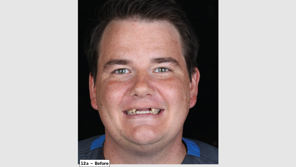 cm1403-lighting-esthetic-zone-12a