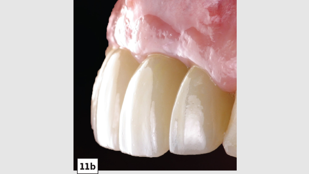 cm1403-lighting-esthetic-zone-11b