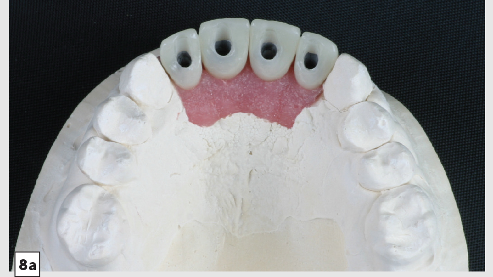 cm1403-lighting-esthetic-zone-08a